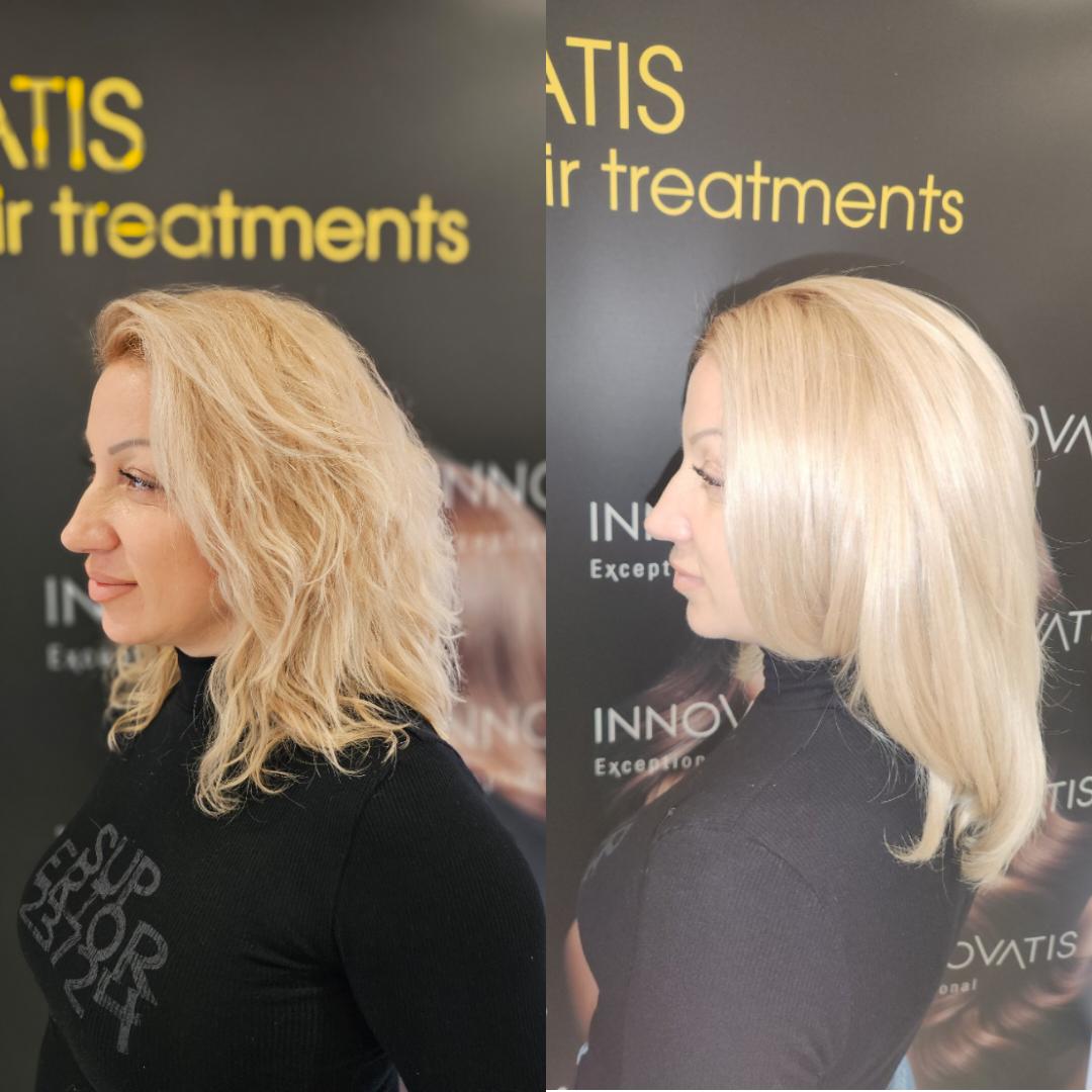 Innovatis Anti Age